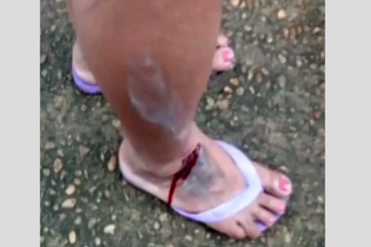 mulher passa por cirurgia2