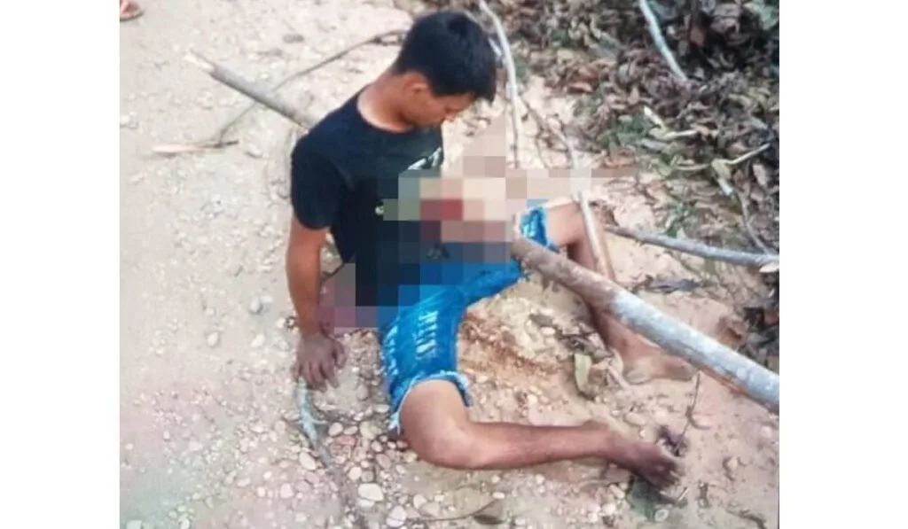Jovem fica com tronco atravessado no tórax após acidente com moto.