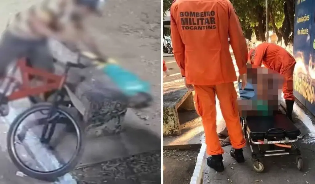 Homem tem corpo queimado enquanto dormia em praça no norte do Tocantins.