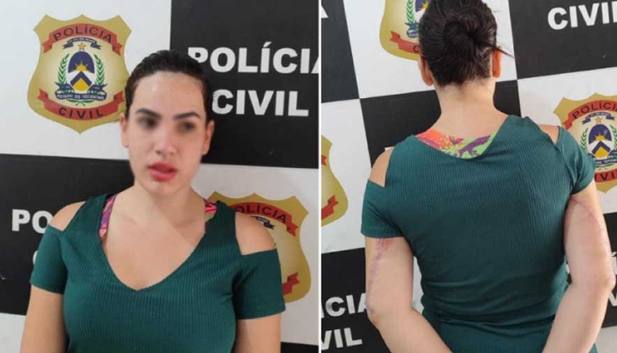 Jovem é presa suspeita de aplicar golpe do falso PIX após fazer procedimentos estéticos.